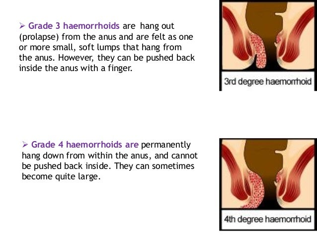 Black pussy feast Sex position foam